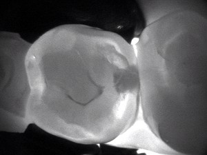 Malcomson Dentistry Carivu